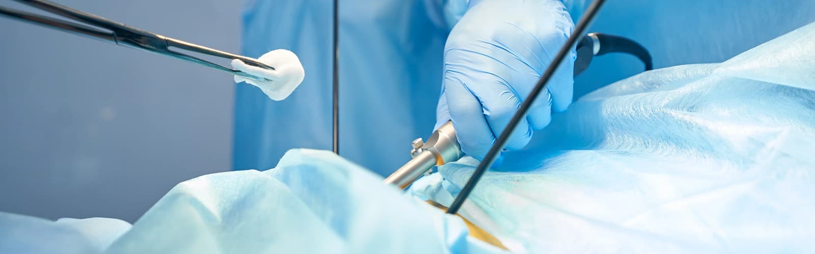 Laparoscopic & General Surgery