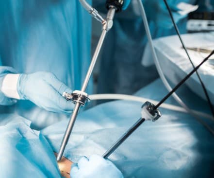 Laparoscopic & General Surgery