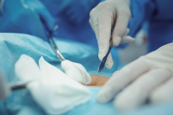 Why Choose Sir Ganga Ram City Hospital?