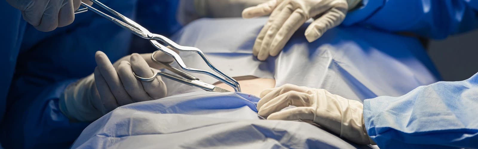 Minimal Access Surgery
